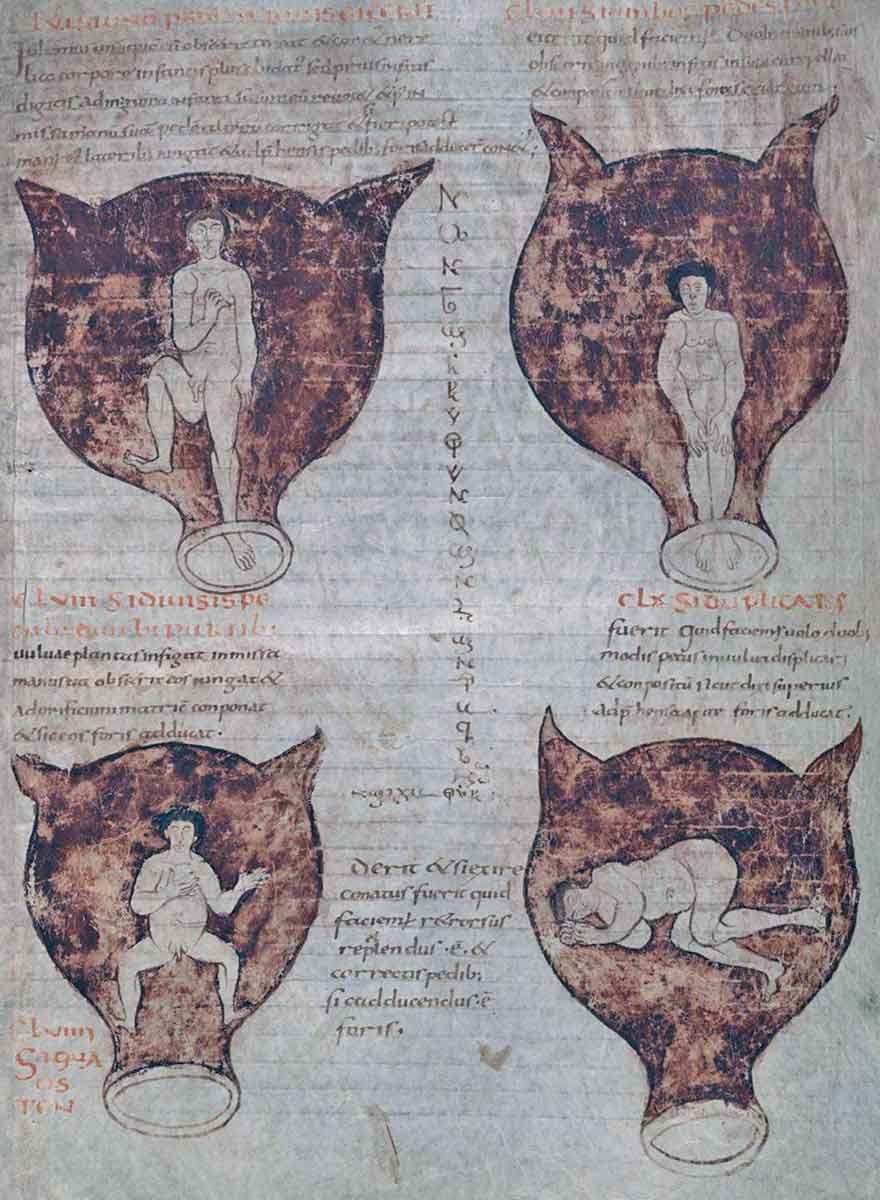 fetal positions soranus roman medicine