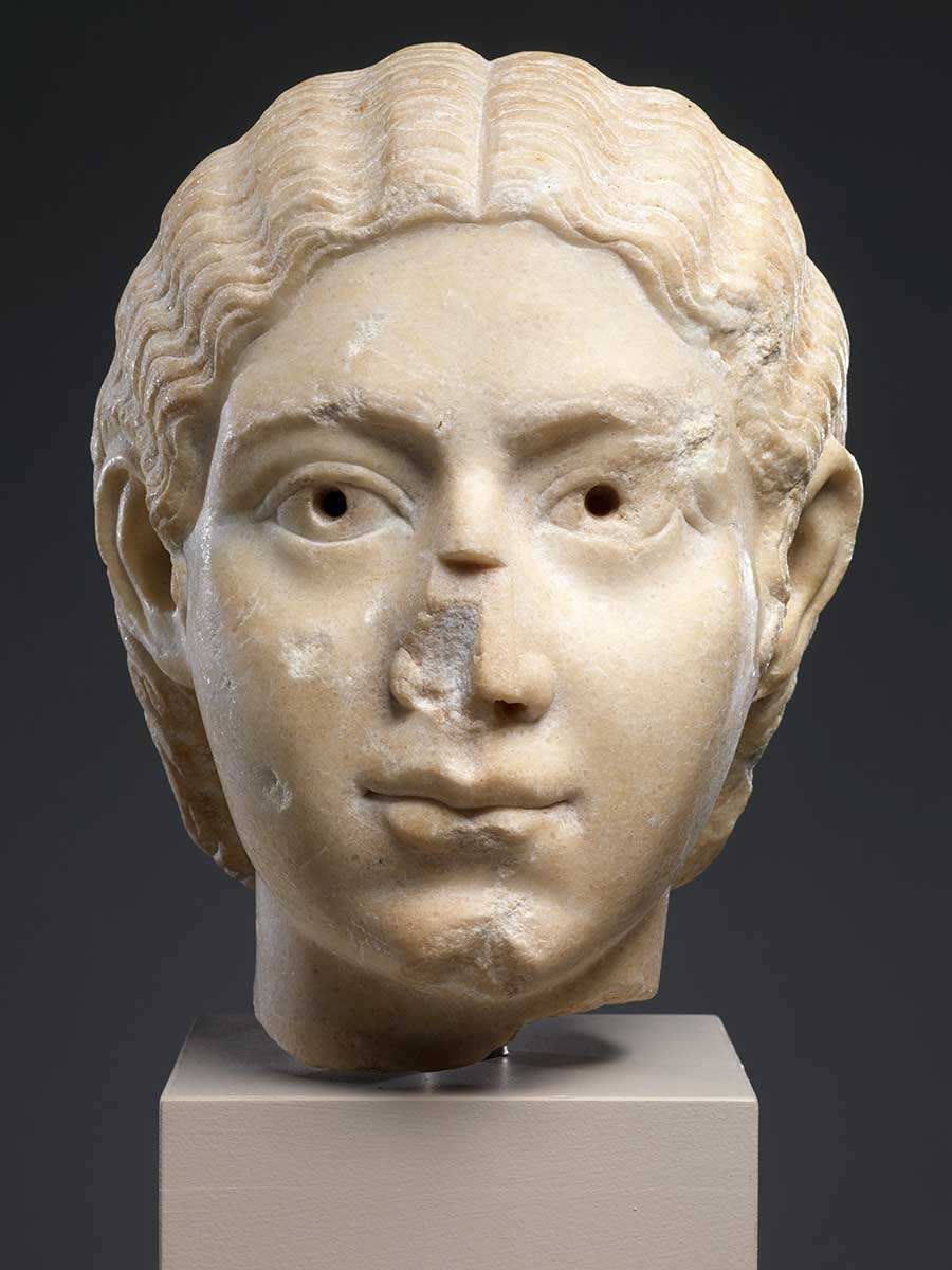 rhinoplasty needed statue