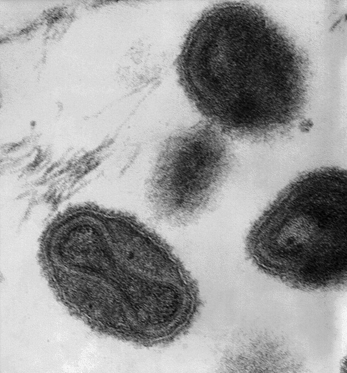 Smallpox virus transmission electron micrograph